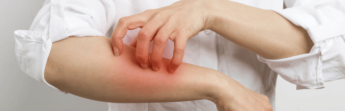 Latexallergie bei Einweghandschuhen - Symptome, Ursachen und Alternativen