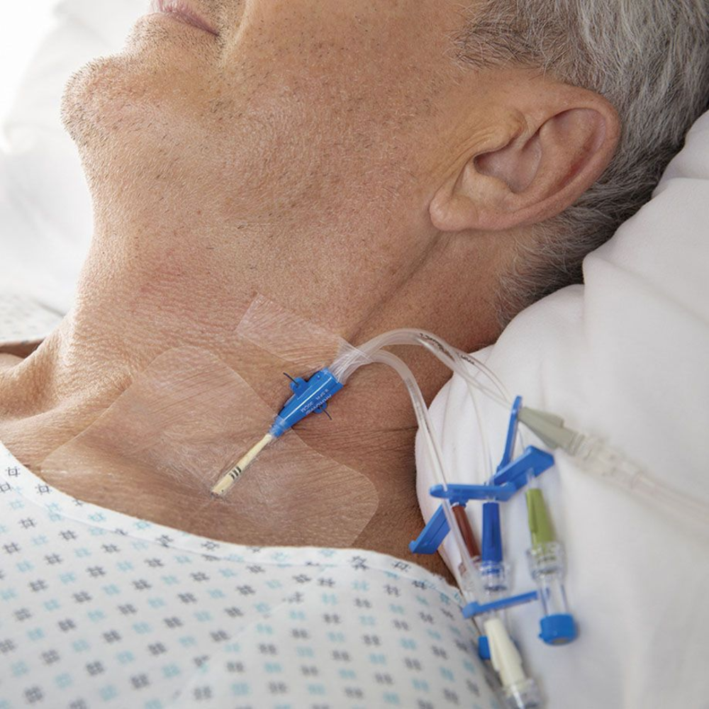 A close-up of a patient shows a central venous catheter inserted into their neck, secured with BSN Leukomed® T sterile, waterproof wound dressing 10 x 12.5 cm from BSN Medical GmbH for sterile wound care. The patient is lying on a hospital bed wearing a patterned nightgown, surrounded by various medical tubes and connectors.