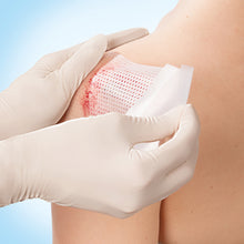 Cuticell Contact, Silicone Wound Dressing – In Use